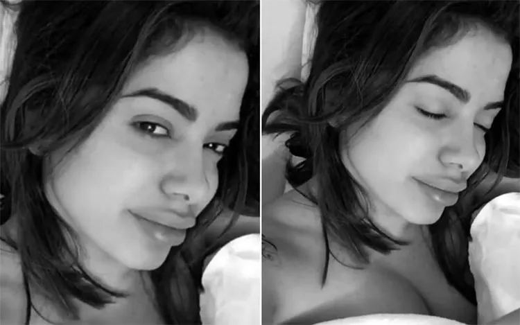 A cantora voltou a aparecer com boca inchada e virou alvo de críticas e piadas na internet