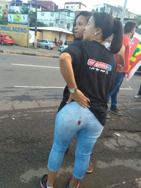 Lidinalva Maciel foi uma das vítimas atingidas pelas balas de borracha
