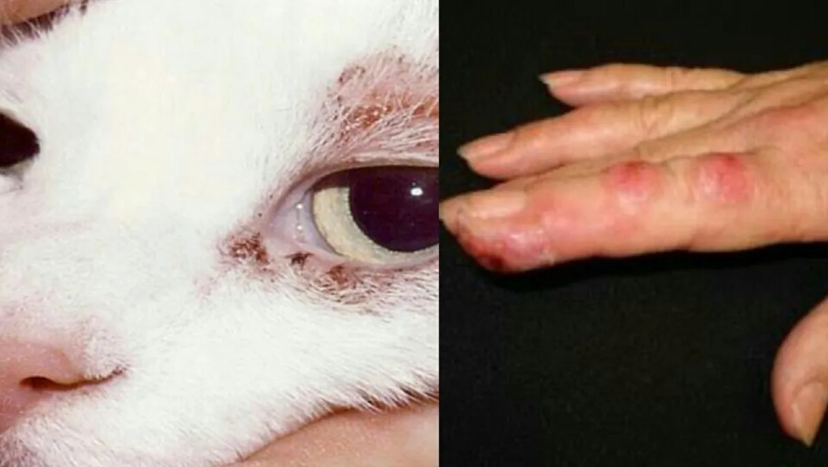A Esporotricose é causada pelos fungos do gênero Sporothrix, que pode ser encontrados na terra, farpas de madeir, na unha ou boca de felinos (gatos) e entre outros