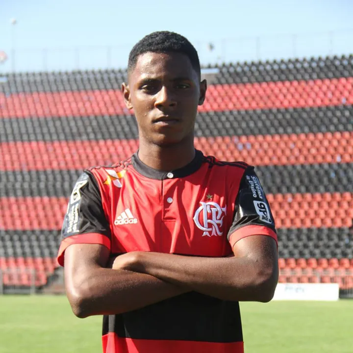 Jhonata sofreu queimaduras de 3° grau em mais de 30% do corpo