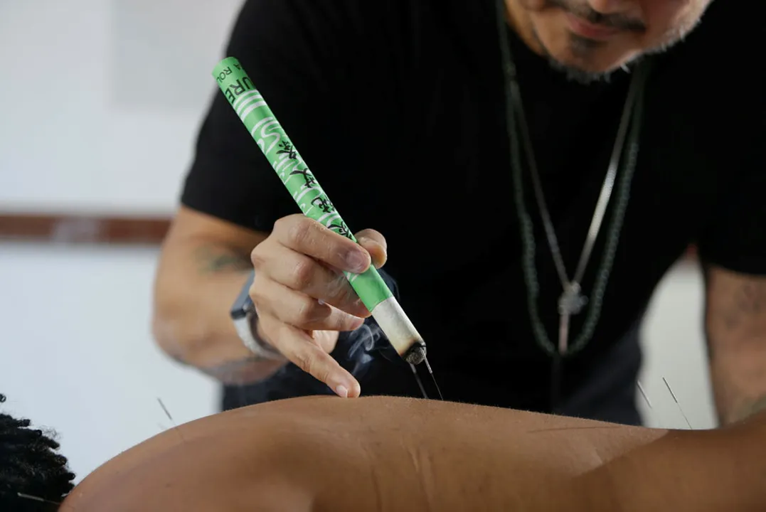 Evento visa informar sobre uso da acupuntura contra dor