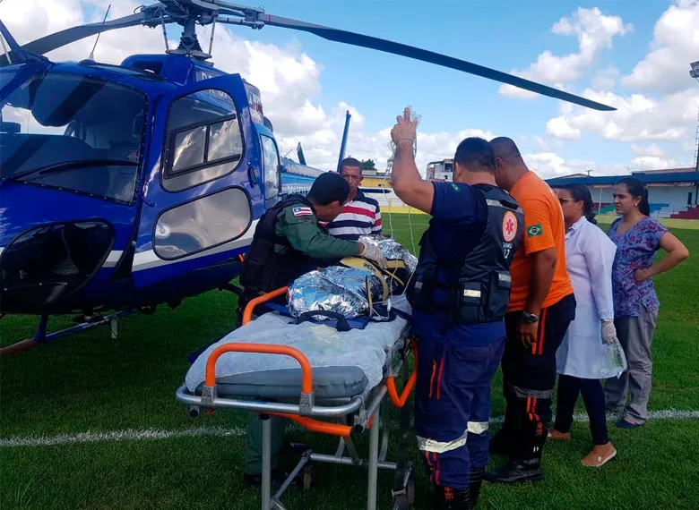 Criança foi vítima de acidente doméstico e teve 80% do corpo queimado