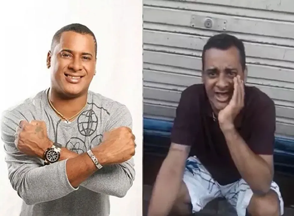 Aparência do cantor chocou os fãs