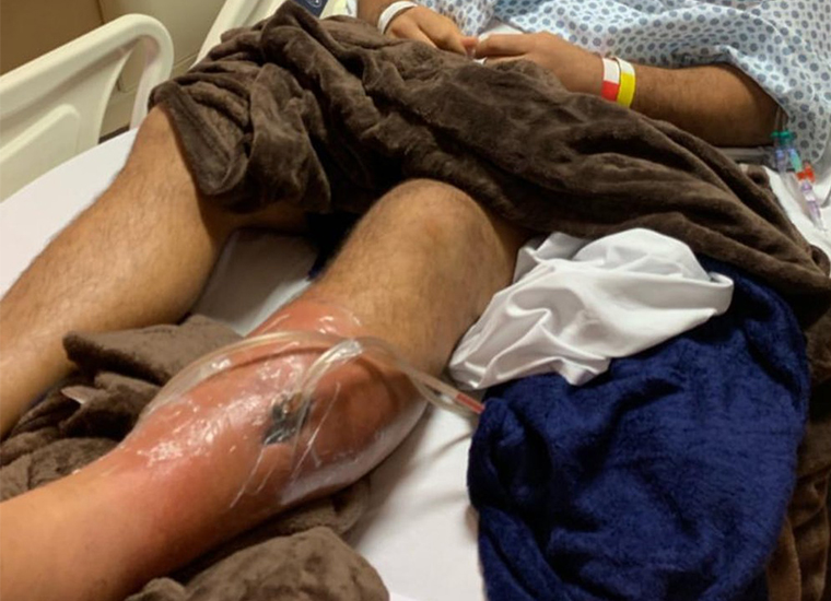 Imagem ilustrativa da imagem Fora do UFC na Rússia, Júnior Cigano é internado com bactéria na perna