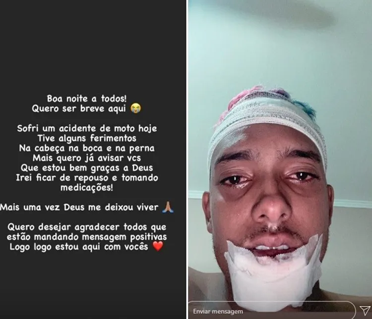 Funkeiro reapareceu nas redes sociais para falar sobre acidente | Foto: Reprodução | Instagram