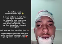 MC Brinquedo acalma fãs após acidente de moto: "Estou bem"