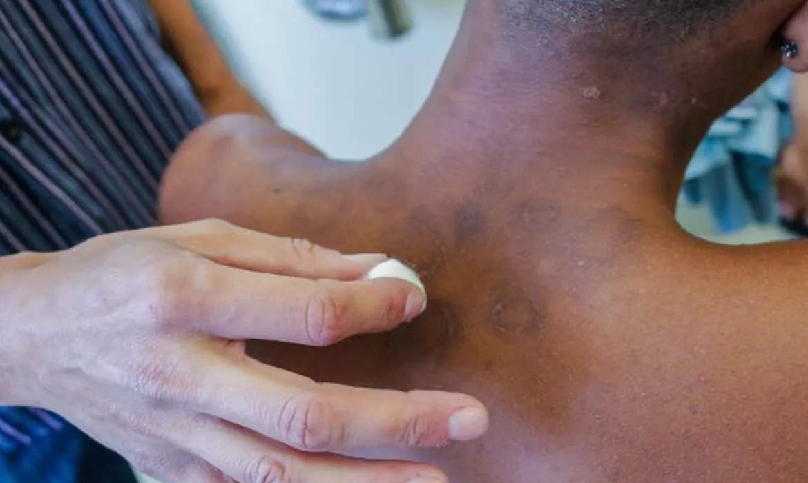 Nova oferta de medicamento traz alternativa para pacientes resistentes | Foto: Divulgação | SMS de Mesquita-RJ