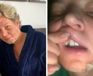 Joice Hasselman acorda com fraturas no corpo após desmaio e crê ter sido vítima de "atentado"