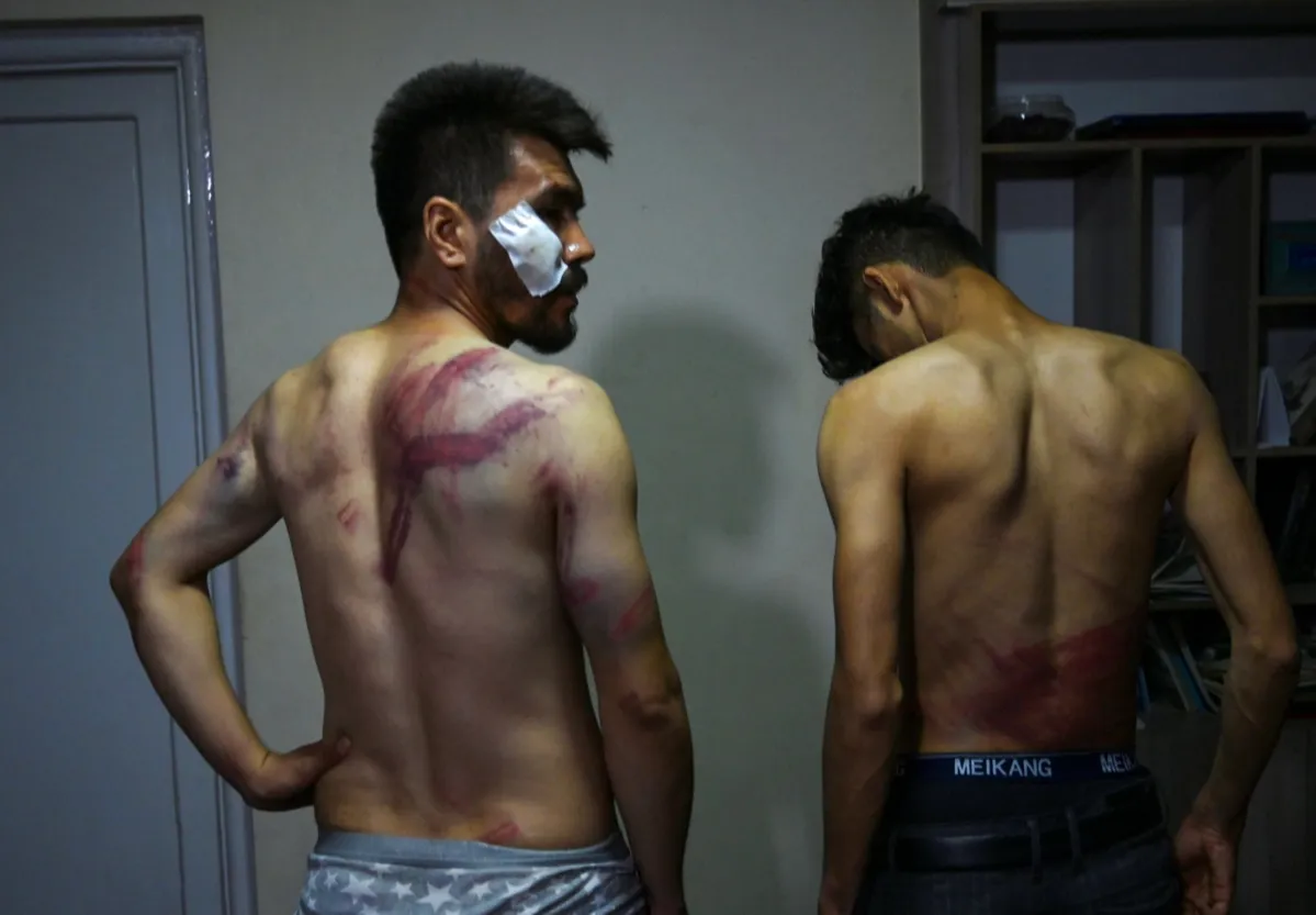 O fotógrafo Nematullah Naqd e o repórter Taqi Daryabi foram torturados | Foto: AFP