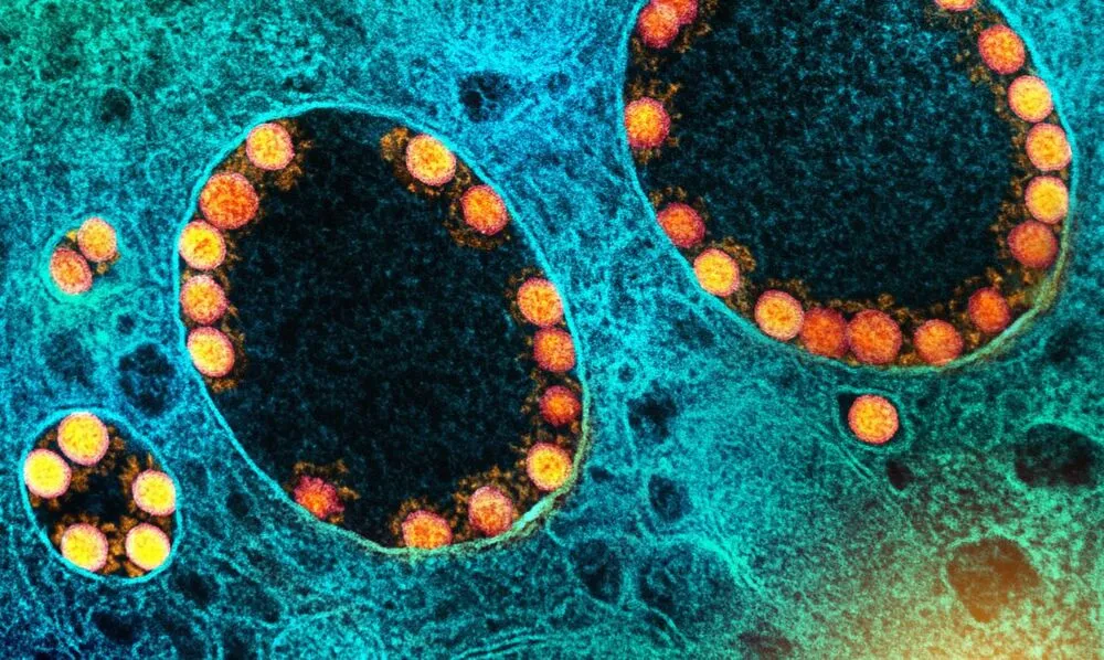 A descoberta abrange medicamentos que inibem enzimas virais essenciais para replicação do SARS-CoV-2 em células humanas infectadas.