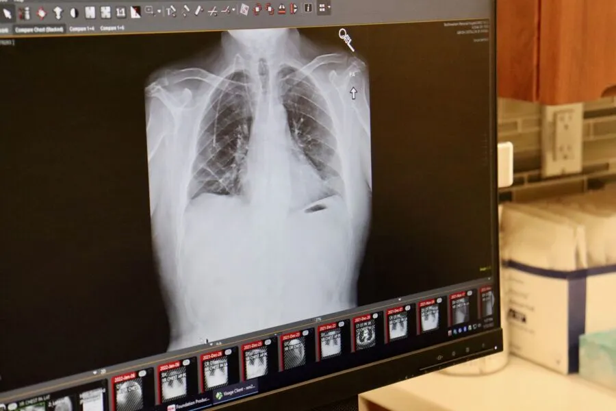 Apesar do estágio avançado, o câncer de Khoury não havia se espalhado para outras partes do corpo, o que permitiu que a cirurgia fosse realizada