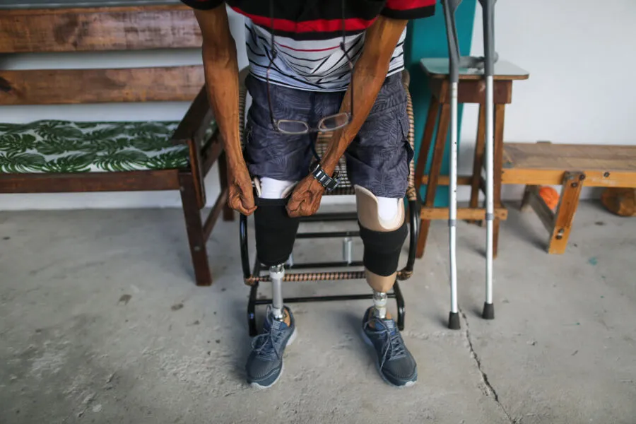 Antes de controlar o diabetes, Marialdo Reis sofreu amputação nas duas pernas