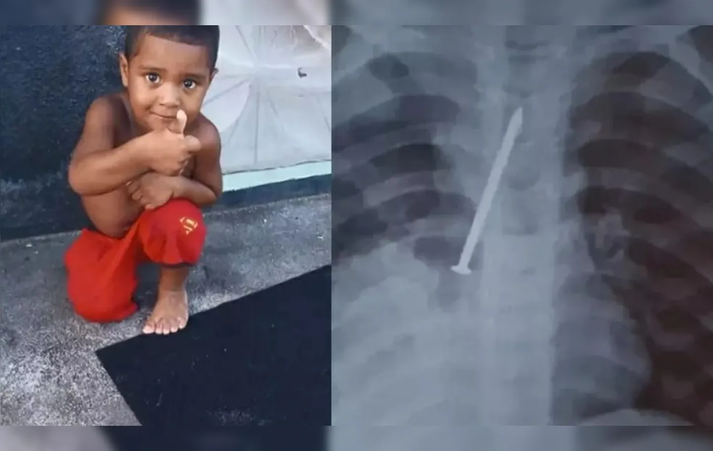 Família levou a criança várias vezes a uma unidade municipal de saúde de Canavieiras, no sul do estado, e diz que nenhum exame foi pedido