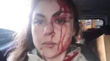 Imagem ilustrativa da imagem Defesa de procurador que agrediu mulher alega surto psicótico