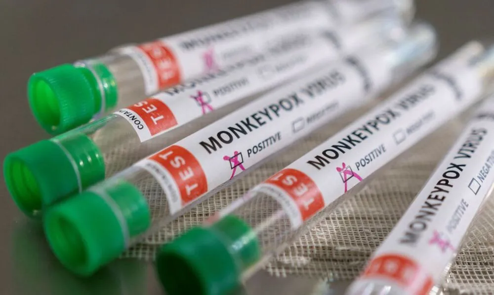 O antiviral Tecovirimat será adquirido por meio da Organização Pan-Americana de Saúde