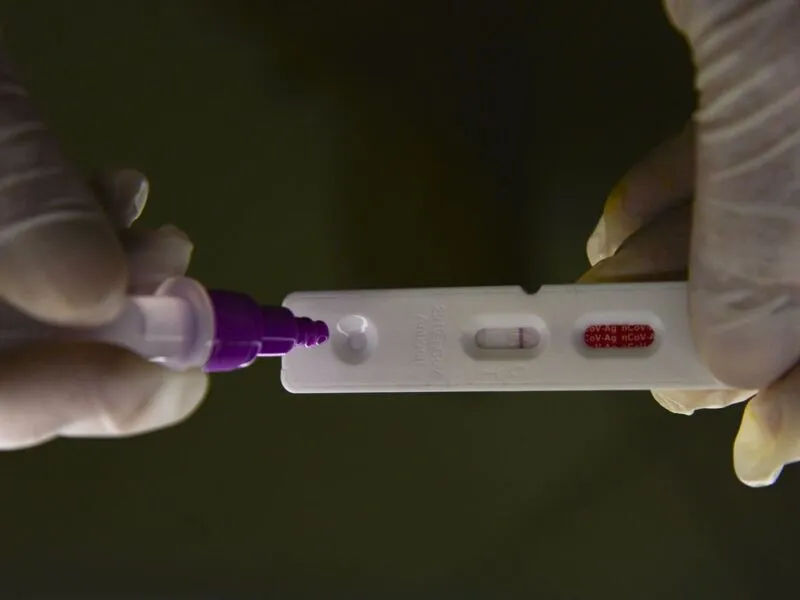 O número de casos em acompanhamento de covid-19 está em 104.692