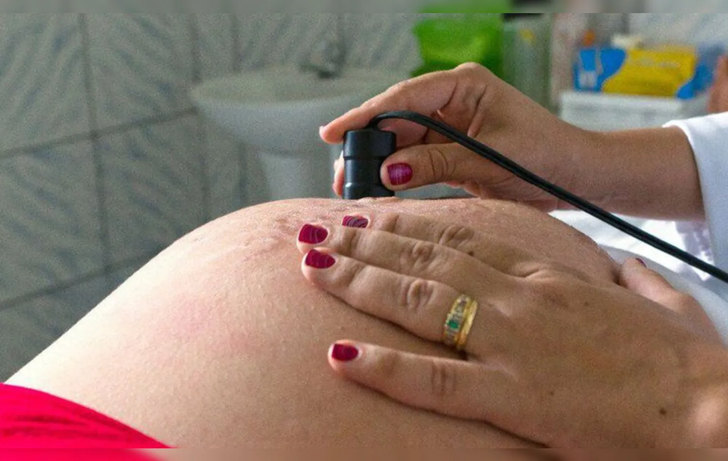 A doença ocorre mais em grávidas de municípios dos estados do Amazonas, do Acre, de Rondônia e do Pará
