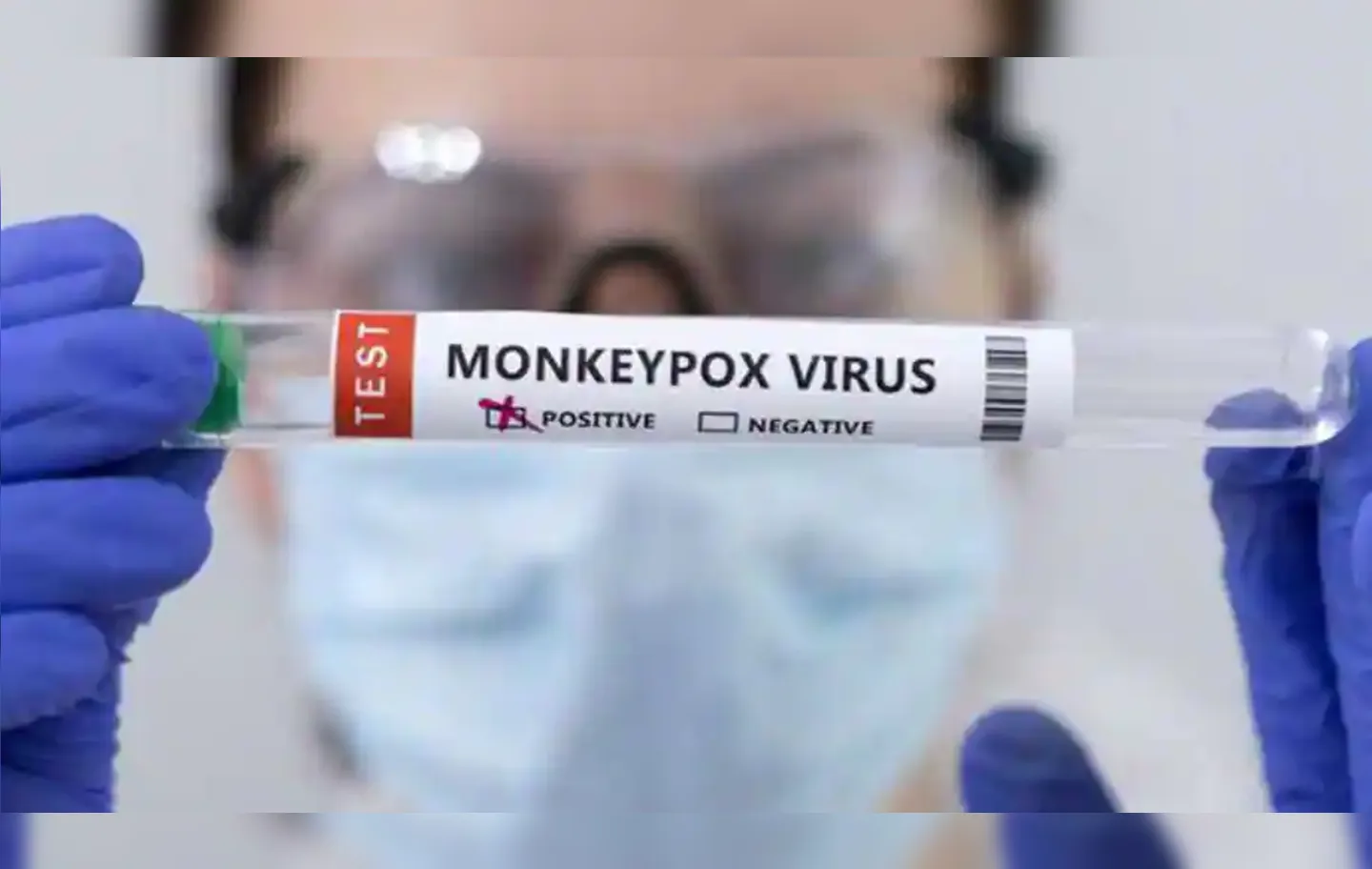 OMS declarou a varíola dos macacos como emergência de saúde pública de interesse internacional