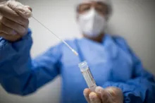 Imagem ilustrativa da imagem Brasil já adquiriu 49 mil vacinas contra a varíola dos macacos