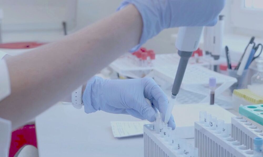 Reinfecções analisadas geneticamente mostram 85% de contaminações por linhagens diferentes