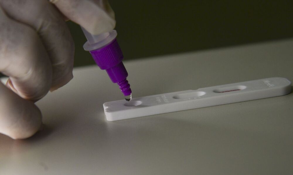 Testes positivos se mantém num patamar elevado há algumas semanas