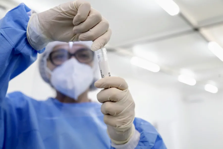 Desde o início da pandemia foram registrados  mais de 1,7 milhões casos foram confirmados