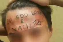 Imagem ilustrativa da imagem Jovem que teve testa tatuada com 'sou ladrão e vacilão' é preso em SP