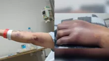 Imagem ilustrativa da imagem Hospital se posiciona sobre erro que amputou mão de gestante
