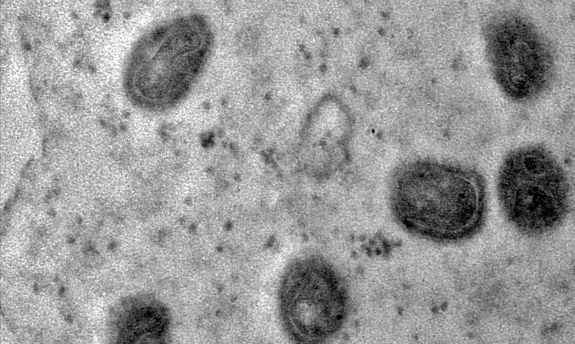 A mpox (ou varíola dos macacos) é uma doença zoonótica viral