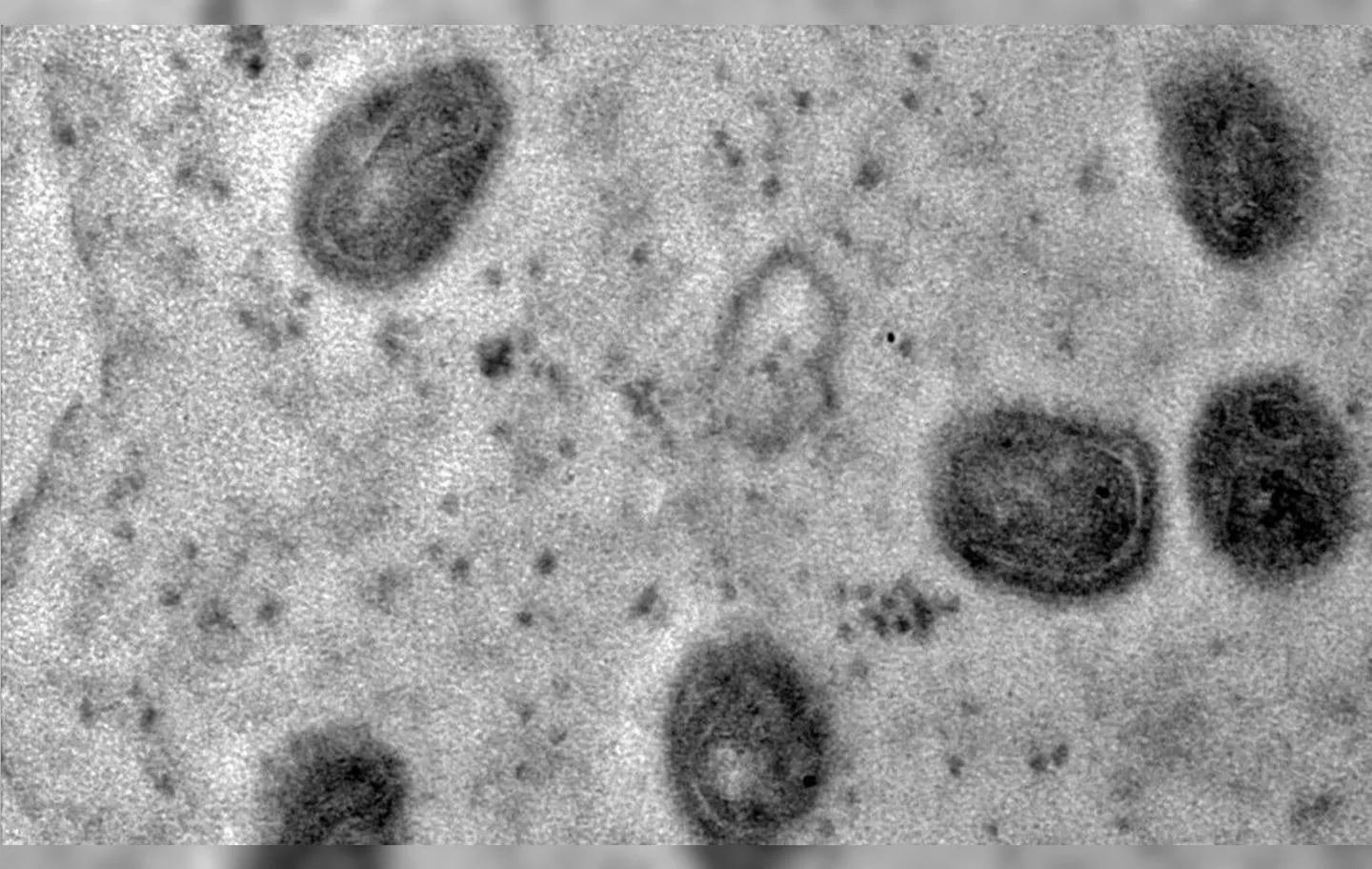 A mpox (ou varíola dos macacos) é uma doença zoonótica viral