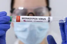 Imagem ilustrativa da imagem Bahia recebe doses de vacinas contra Monkeypox