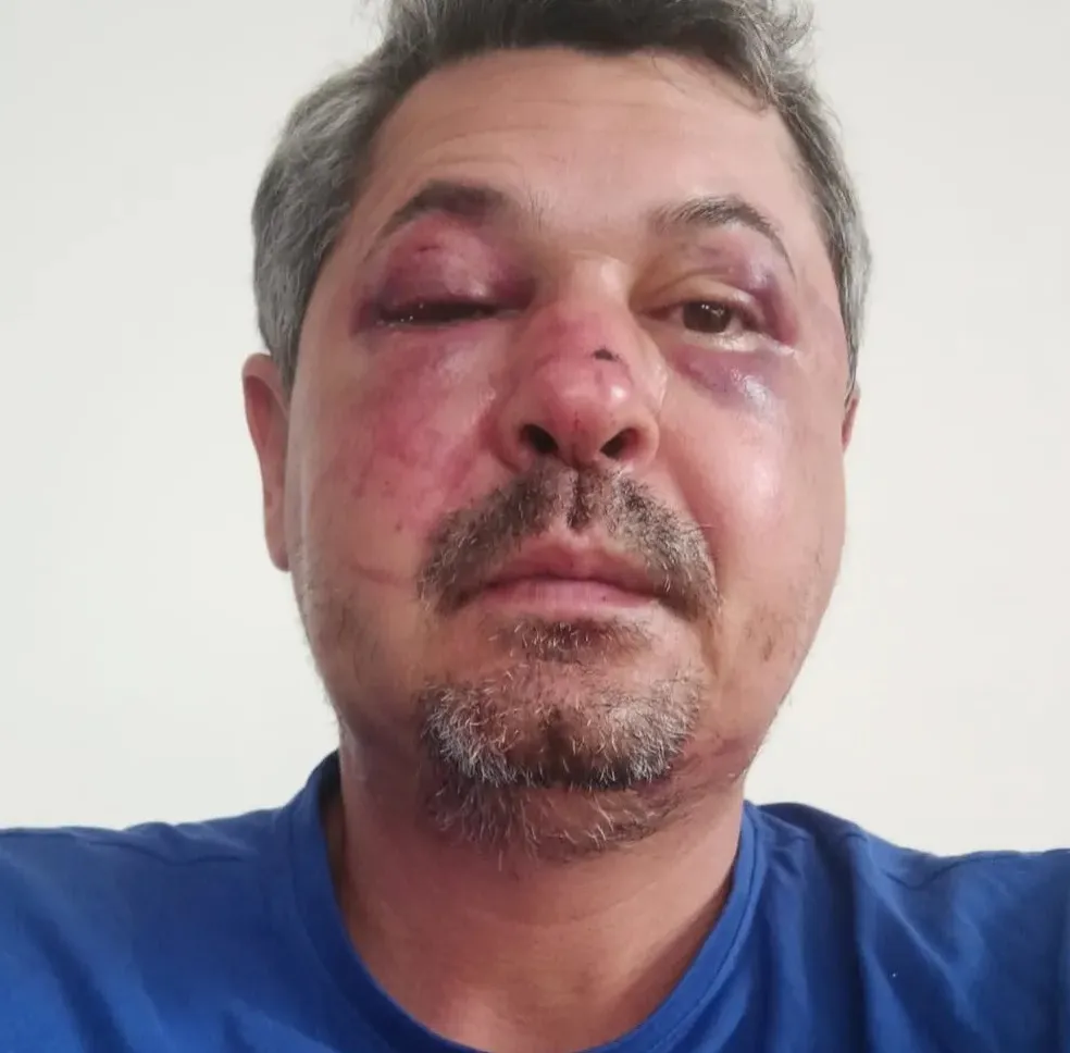 O brasileiro conversava com o dono do café quando começou a ser agredido