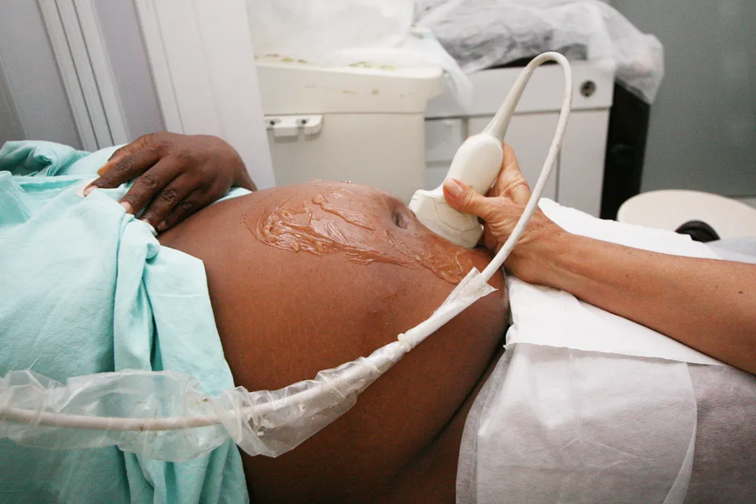 Ainda hoje, a cada 
dez gestantes, a 
metade integra a
 triste estatística 
de óbitos por 
causas evitáveis