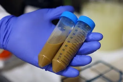 Transplante ainda não é regulamentado no Brasil