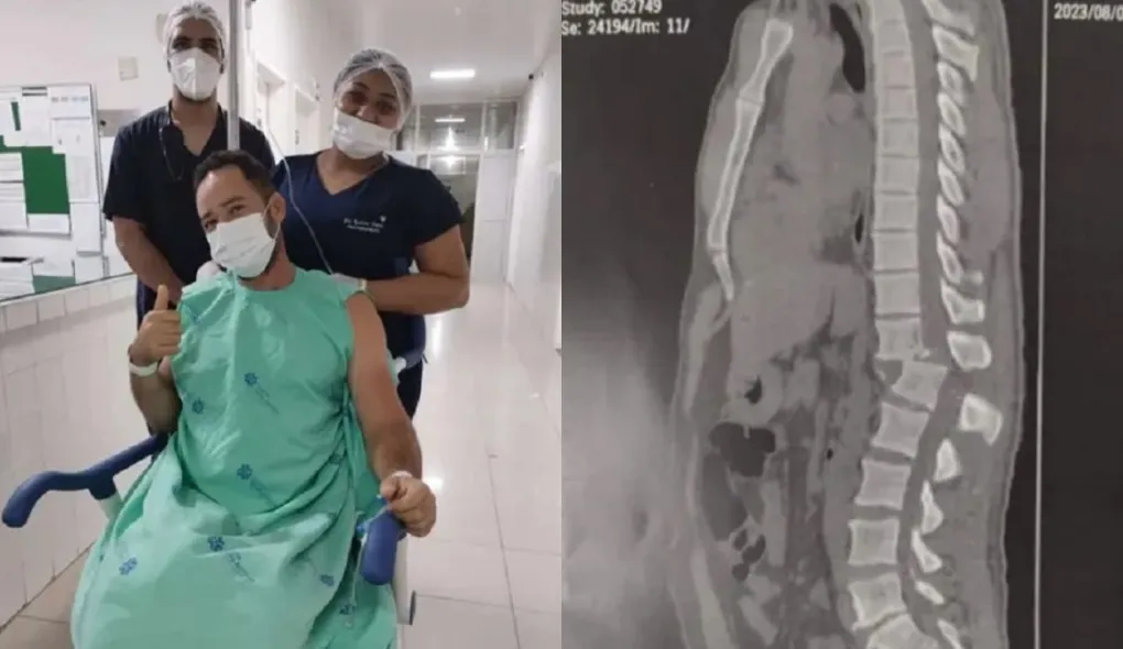 Regilânio teve lesões na coluna ao ser atingido por um aparelho com 150 quilos