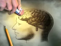 Imagem ilustrativa da imagem Com testes no início, medicamento para Alzheimer tem bons resultados