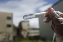 Imagem ilustrativa da imagem Testes para chikungunya e tuberculose estão escassos no Brasil