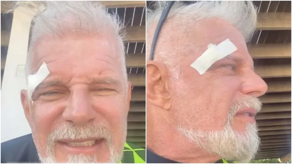 Imagem ilustrativa da imagem Ator Raul Gazolla sofre acidente em praia no CE: "abri a testa"