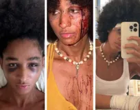 Imagem ilustrativa da imagem Transexuais são agredidas em bar no Rio de Janeiro