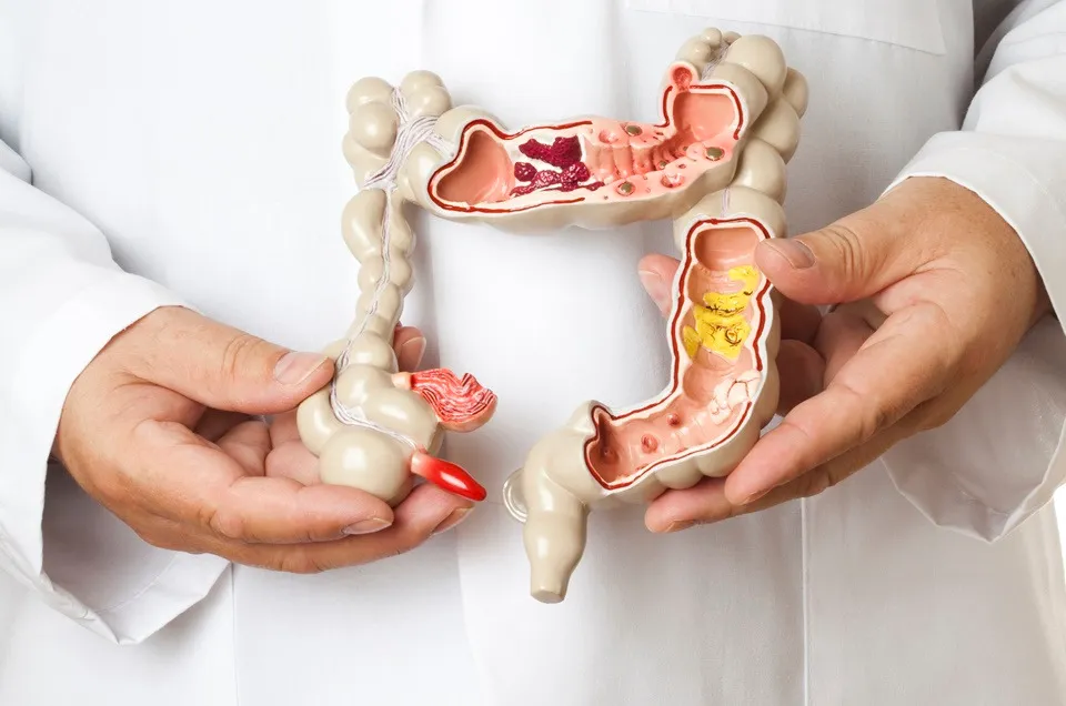 Imagem ilustrativa da imagem Março Azul: Bahia tem alto índice de morte por câncer de intestino