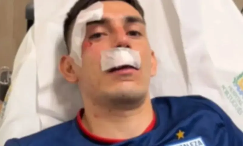 Gonzalo Escobar foi um dos atletas do Fortaleza feridos no ataque ao ônibus feito por uma torcida  organizada do Sport