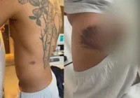 Após ser agredido, PM desabafa: "Nunca mais coloco uma farda"