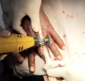 Imagem ilustrativa da imagem Bombeiros retiram anel preso há um mês em dedo de homem; VÍDEO