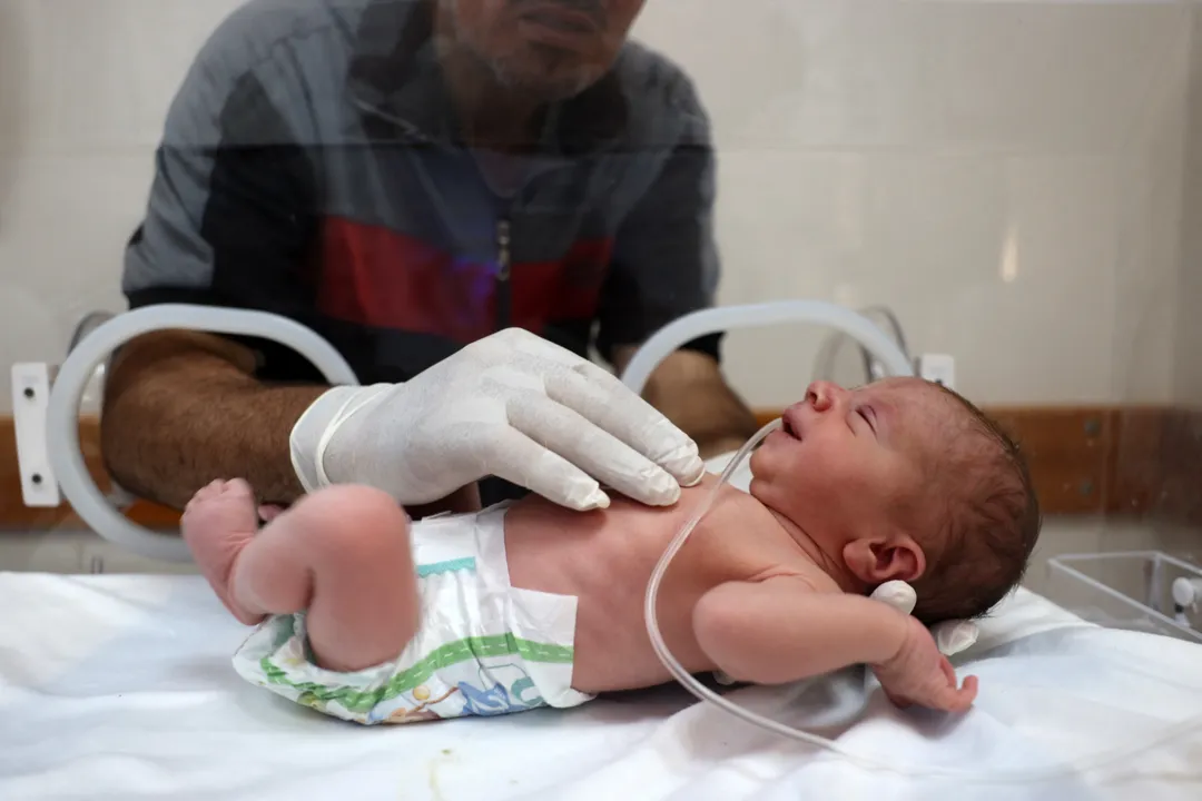 O recém-nascido estava inicialmente em estado crítico, mas recebeu oxigenio e cuidados médicos