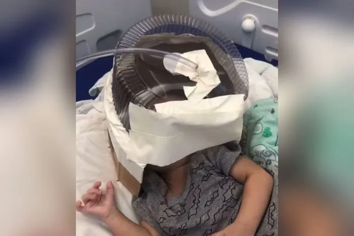Imagem ilustrativa da imagem Hospital do RN usa embalagem de bolo como máscara de oxigênio em bebê