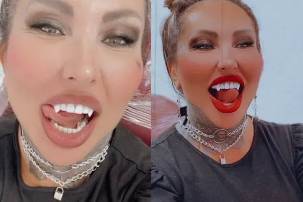 Ela explicou que nasceu com os dentes mais pontudos, mas que perdeu as características