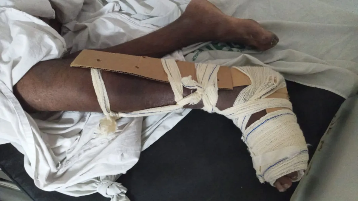 Paciente com suspeita de fratura teve perna "imobilizada" com papelão