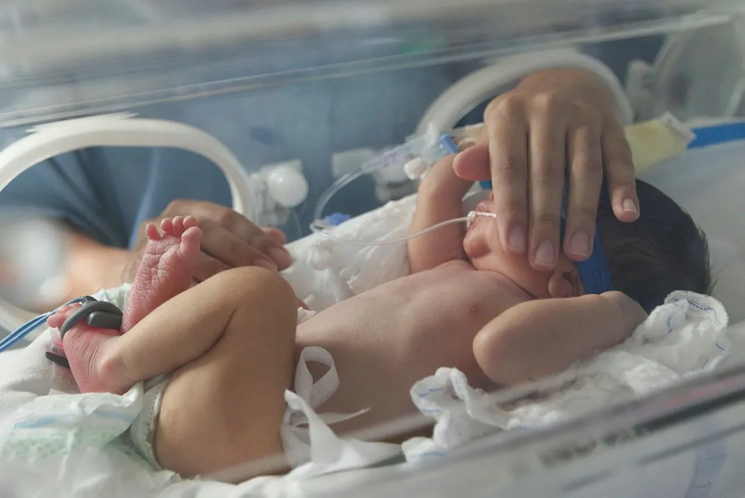 Bebês na UTI Neonatal do Hospital Universitário de Brasília (HUB-UnB)