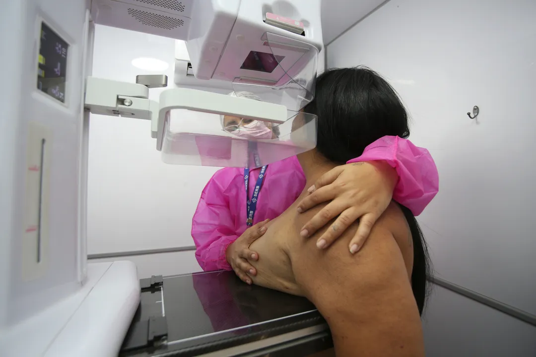 Entidades da área da saúde já apresentaram parecer para manter a mamografia de rastreio para mulheres a partir dos 40 anos