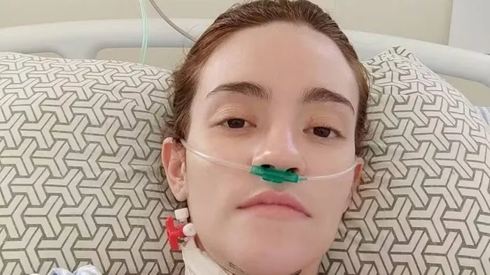 Carolina começou a sentir os primeiros sintomas da neuralgia dos trigêmeo quando tinha apenas 16 anos